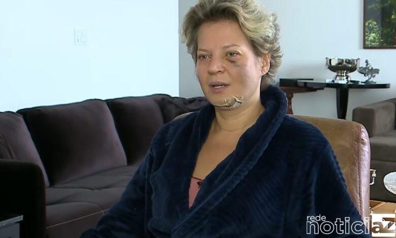 Caso Joice Hasselmann: Inquérito sobre agressão é enviado para o Ministério Público