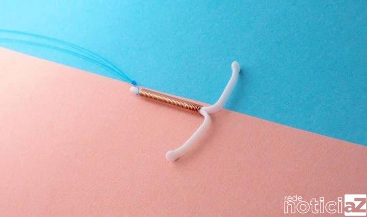 Polêmica: Inserção do DIU na mulher depende do aval do marido