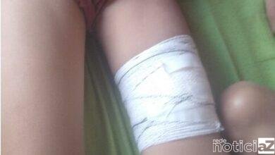 Criança é atacada por tubarão no Litoral de São Paulo