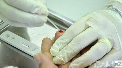 Várzea Paulista inicia testagem contra doenças sexualmente transmissíveis