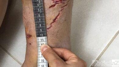 Pesquisadores confirmam que turista francês sofreu ataque de tubarão em Ubatuba