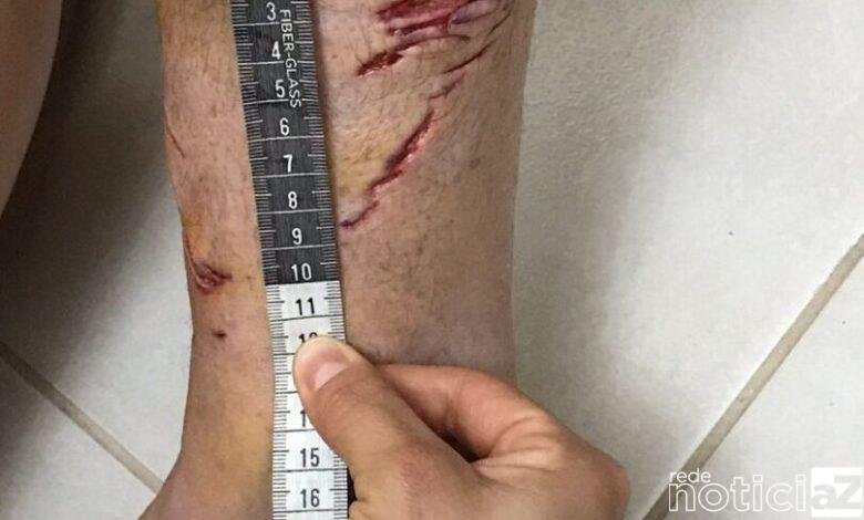Pesquisadores confirmam que turista francês sofreu ataque de tubarão em Ubatuba