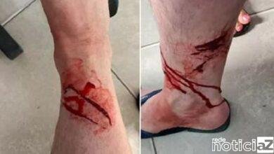 Turista é atacado por um Tubarão em Praia de Ubatuba