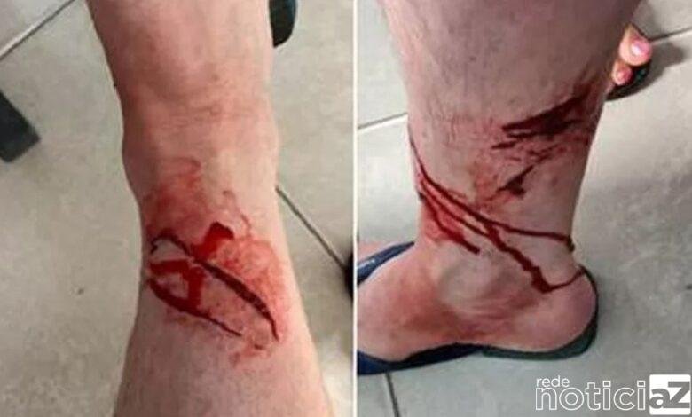 Turista é atacado por um Tubarão em Praia de Ubatuba