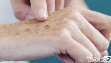 Dezembro Laranja chega para alertar contra o câncer de pele