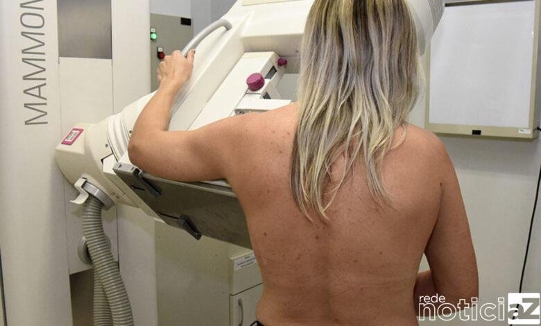 Região de Jundiaí receberá a Carreta da Mamografia