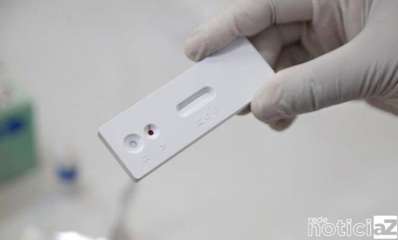 Assintomáticos serão testados contra a Covid-19 em Louveira