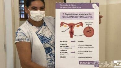 Mutirão de papanicolau é promovido em Louveira