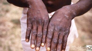 Suro da varíola dos macacos pode ser contido, diz OMS