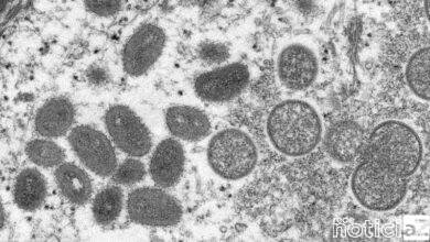 Sobe para seis o número de casos de varíola dos macacos em Jundiaí