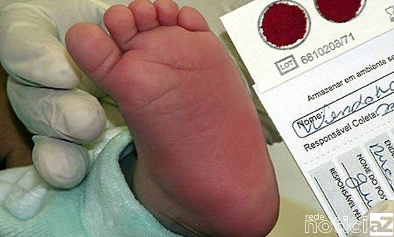 Importância do teste do pezinho é reforçada em hospital de Jundiaí