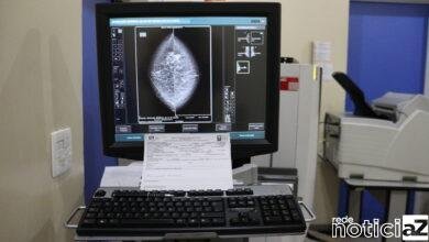 Busca por exames de mamografia andam em baixa em Campo Limpo