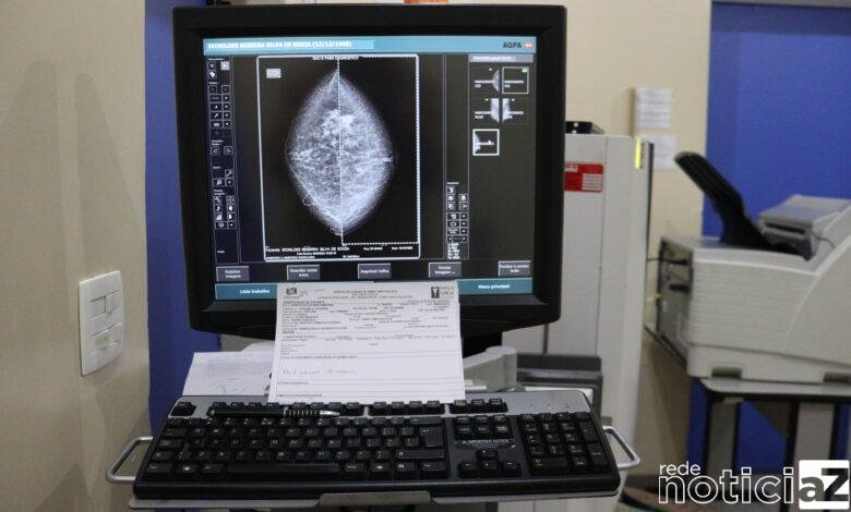 Busca por exames de mamografia andam em baixa em Campo Limpo