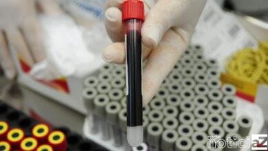 Ações contra hepatites virais são executadas em Jundiaí