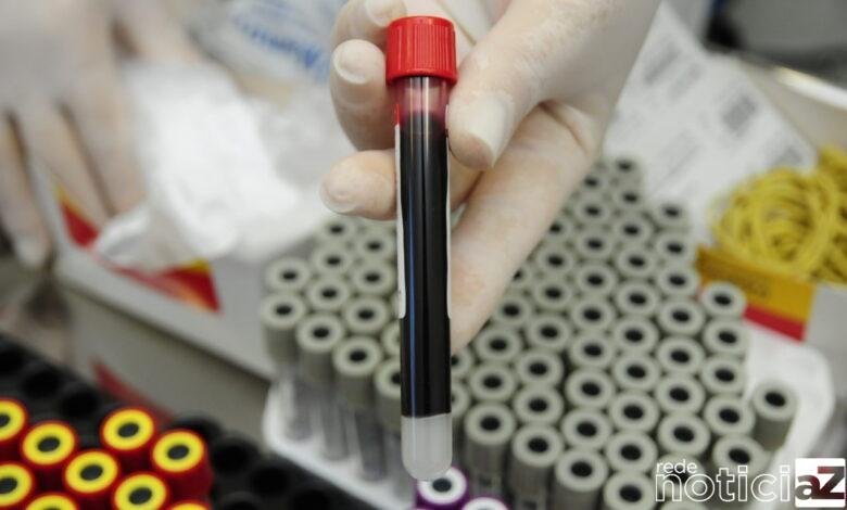 Ações contra hepatites virais são executadas em Jundiaí