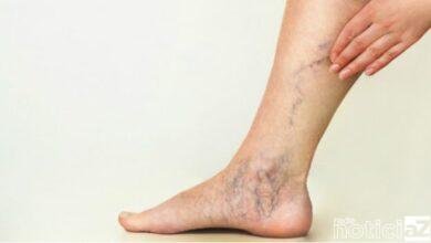 Tome cuidado com o consumo de pílulas anticoncepcionais