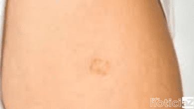 Vacina BCG agora é aplicada apenas com agendamento