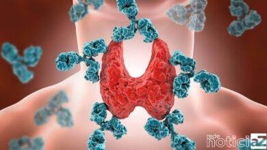 Tireoidite de Hashimoto: doença é um perigo na vida das mulheres