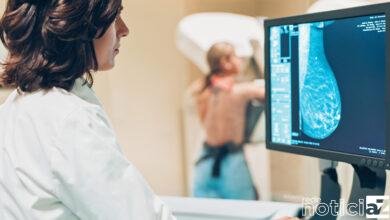 Campo Limpo Paulista prepara programação do Outubro Rosa