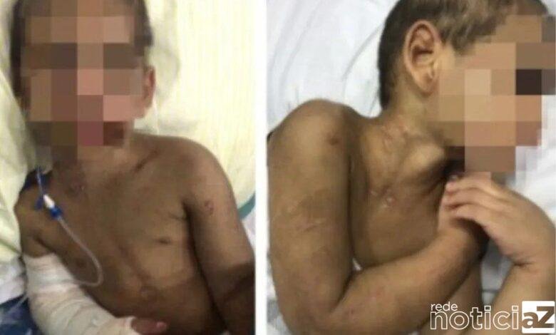 Menino que teve oito costelas e braço quebrados recebe alta do hospital após 27 dias internado