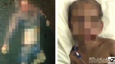 Morre padrasto que espancou menino de quatro anos junto com mãe em São Vicente