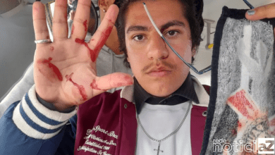 Escola técnica de Jundiaí suspende aulas após estudantes serem atacados por bolsonaristas