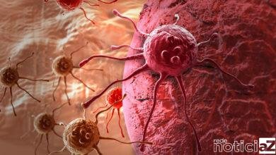 No Dia Nacional de Combate ao Câncer, a atenção ao corpo deve ser redobrada