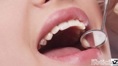 Câncer de boca gera danos nos lábios e na língua