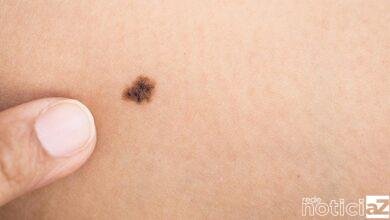 Dezembro Laranja: o mês para cuidar da pele