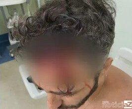 Thiago Rodrigues: Investigações mostram que ator caiu sozinho e não houve assalto