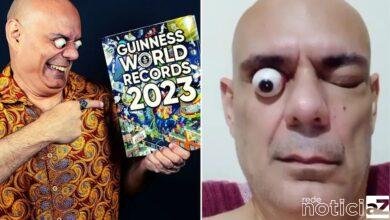 Homem com os olhos mais esbugalhados do mundo é de Santos