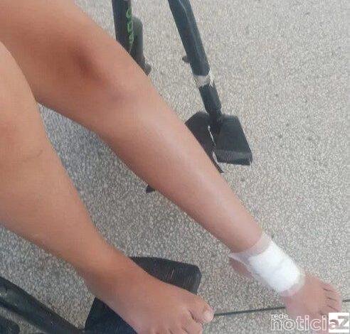 Criança é perfurada por ferrão de 7 cm de peixe venenoso e é hospitalizada