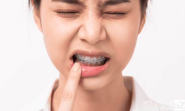 Lesões na boca que não cicatrizam podem ser sinais de câncer