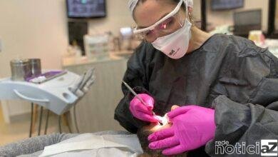 Lente dentária: mais uma moda vinda do BBB 23