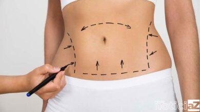 Novela da Globo aborda cirurgias procuradas por adolescentes