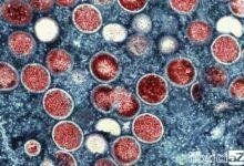 OMS diz que Mpox não é mais emergência sanitária global