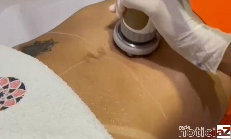 Especialista dá dicas de como tirar a flacidez abdominal e recuperar o físico