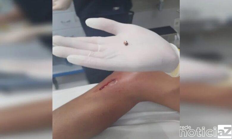 Criança é vítima de espingarda de pressão em Várzea Paulista