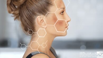 Desenvolveu melasma durante a gravidez? Saiba como amenizar as manchas