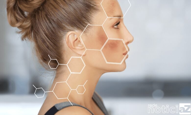 Desenvolveu melasma durante a gravidez? Saiba como amenizar as manchas