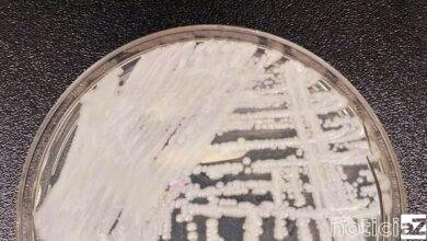 Fiocruz e Pasteur vão pesquisar sobre danos dos fungos no ser humano