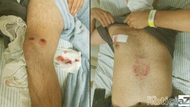 VÍDEO - PM é atingido por tiros ao abordar suspeitos em adega