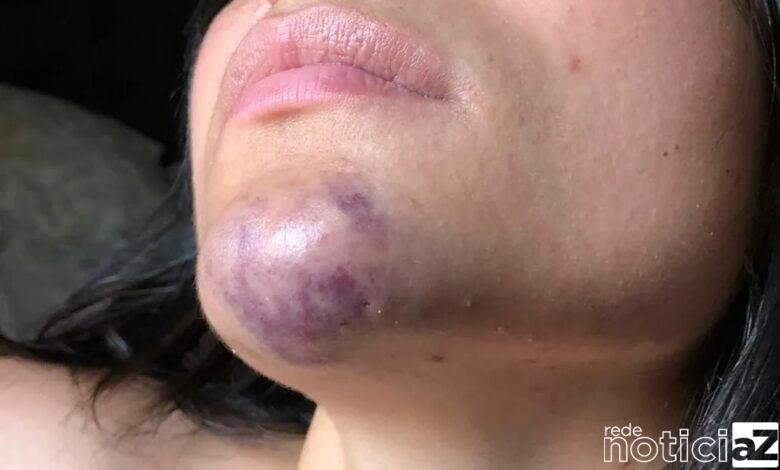 Homem é preso após agredir sua ex-namorada com um capacete em shopping