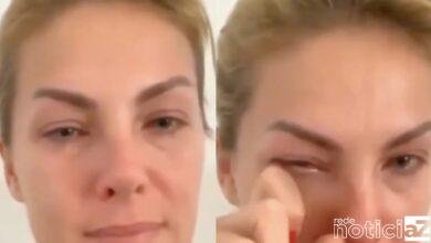 Ana Hickmann relatou cabeçadas e ameaças do marido a Polícia