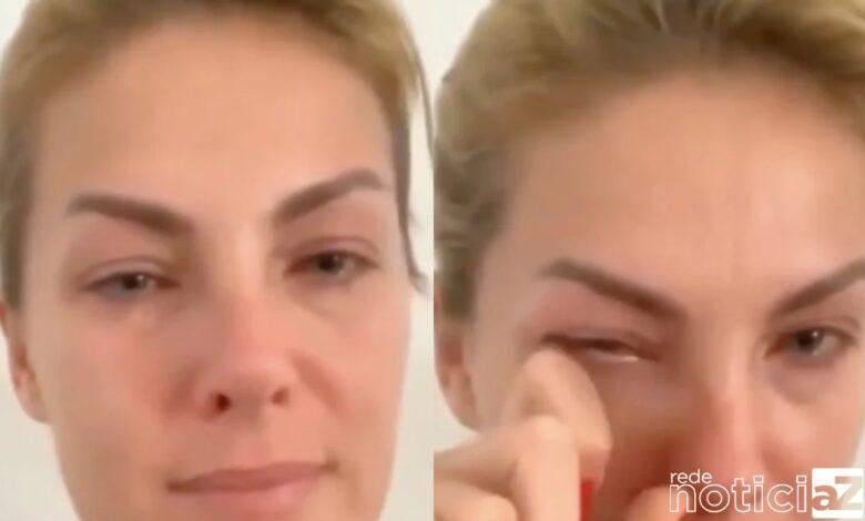 Ana Hickmann relatou cabeçadas e ameaças do marido a Polícia