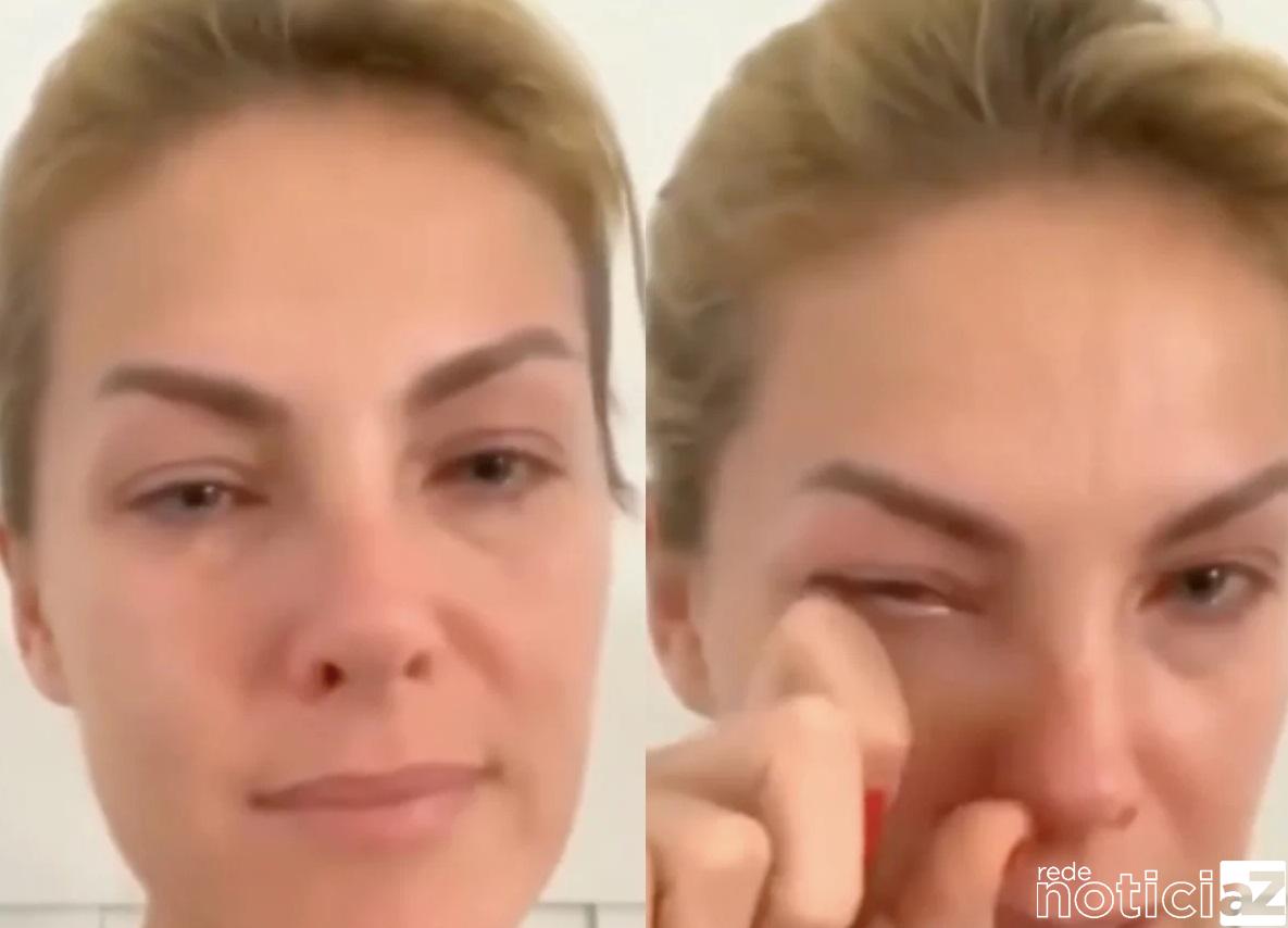 Ana Hickmann Relatou Cabeçadas E Ameaças Do Marido A Polícia Rede Noticiaz