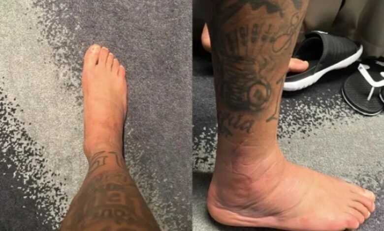 Neymar mostra tornozelo inchado durante recuperação