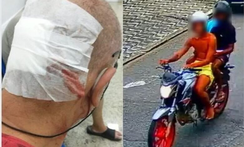 Homem surdo é atingido com diversas coronhadas na cabeça por criminoso e fica ferido no litoral de SP