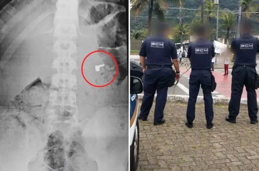 Adolescente engole corrente roubada no Guarujá e é apreendido