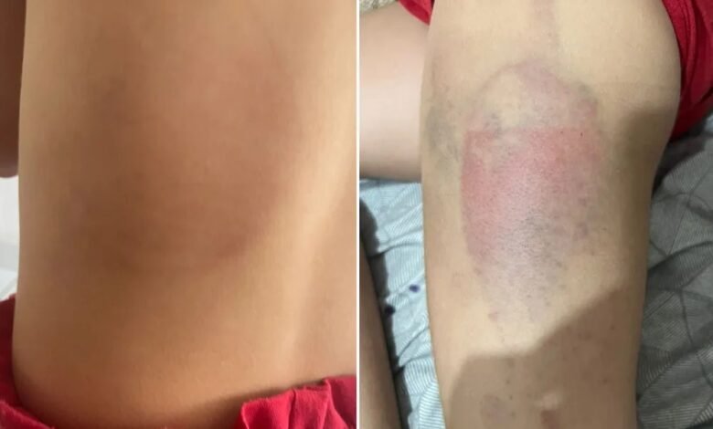 Menina de 7 anos é agredida pelo pai e caso será investigado